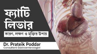 ফ্যাটি লিভার বা লিভারে চর্বির কারণ, লক্ষণ ও চিকিৎসা ? Fatty Liver Symptoms, Causes and Treatment