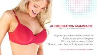 Augmentation mammaire par le Dr SMARRITO