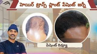 Hair Transplant In Hyderabad | Best Results Center & Surgeon Of Hair Transplant Surgery In Hyderabad