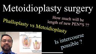 Metoidioplasty vs Phalloplasty . female to male transgender bottom surgery . Penis creation surgery