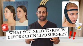 5 Things You NEED To Know Before Getting Chin Lipo