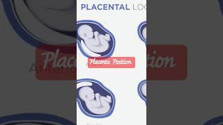 Placenta Position | Ultrasound #baby #pregancyultrasound #genderreveal #ultrasound