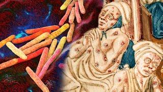 Should You Be Worried About Leprosy?