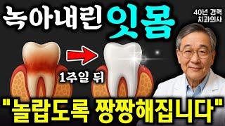 잇몸! '이렇게 해야' 감기, 잇몸병, 입냄새가 싹 사라집니다! 40년차 이비인후과 의사가 매일 하는 루틴, 임플란트 하지마세요! (노후건강 김원석 원장 통합본)