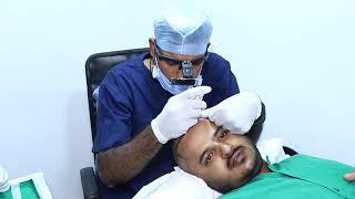 Hair Transplant Surgery Detailed Process at VPLANT ADVANCED HAIR CLINIC - Modified Hair Implantation