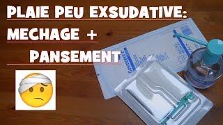 Pansement et méchage d'une plaie peu exsudative: Comment faire??