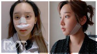 How my life has changed after 30 times of plastic surgery