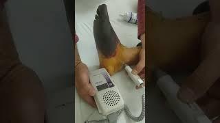 Doppler ultrasound posterior tibial artery triphasic