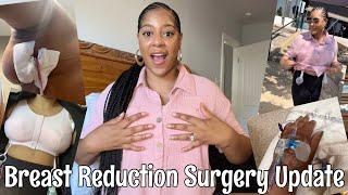 Breast Reduction Surgery Journey | Part 2 | Day of Surgery | Day After | 4 Days After Surgery Update