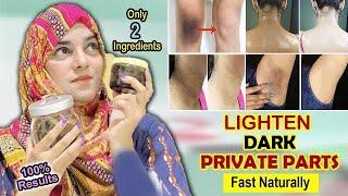 Lighten your DARK Body parts & Private Area Whitening | Dark Intimate Areas Treatment | 100% Result