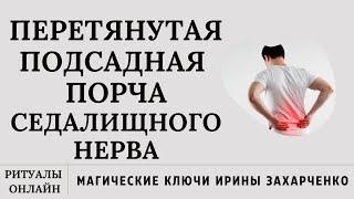 Седалищный нерв. Порча перетянутая, подсадная. Воспаление. Боль. Жжение. Ограничение движения. Шиас.