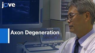 Ultrasonography and Nerve Conduction Study to Screen Axon Degeneration | Protocol Preview