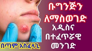 Ethiopia: ቡግንጅን በቤት ውስጥ የማከሚያ ዘዴ/ Boils treatment/Home remedies