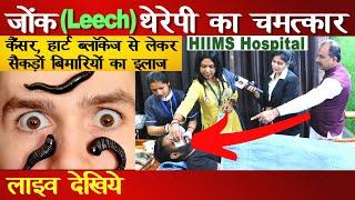 Leech therapy in ayurveda आयुर्वेद की लीच थेरपी Acharya Manish ji | HIIMS Hospital | National Khabar