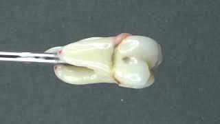 From roots to crown full composite #dentist #smiledentist #dentalwork #dentalclinic