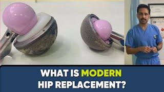 What is Modern Hip Replacement? क्या Latest है हिप रिप्लेसमेंट में ?