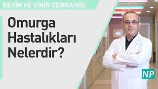 Omurga Hastalıkları Nelerdir?