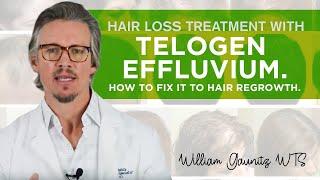 Telogen Effluvium Hair Loss - What is it? How To Fix It Fast