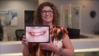 Full Mouth Restoration - Catherine Patient Story