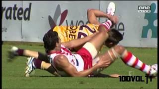 Jaymie Graham Former West Coast Player- WORST leg break you'll EVER SEE!