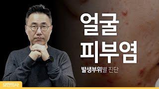 얼굴 피부질환이 무엇인지 모르는 분은 꼭 보세요. 얼굴 피부염이 무엇인지 3초면 알 수 있습니다.