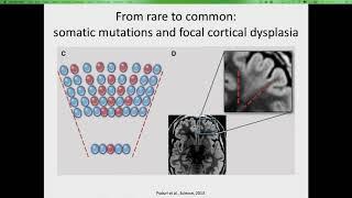 Individualised Treatments for Epilepsy - Following the Genes