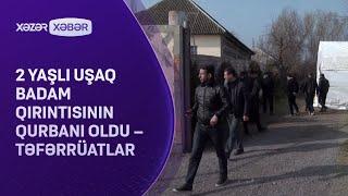 2 yaşlı uşaq badam qırıntısının qurbanı oldu – TƏFƏRRÜATLAR