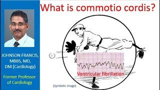 What is commotio cordis?