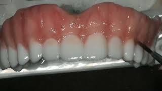 Monolithic denture characterized with anaxgum 8x speed