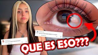 Que tengo en el ojo?? - yaneireach
