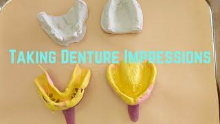Taking Denture Impressions