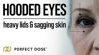 Hooded Eyes - Heavy Lids & Sagging Skin