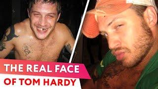 Tom Hardy Breaks The Silence About His Darkest Period |⭐ OSSA