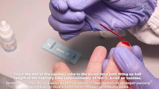 Reszon Lymphatic Filariasis Rapid Test Kit (Brugia Rapid) - Instruction for Use for Whole Blood