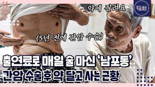 "간이 배 밖으로 안 나올 수가 없지." 간암 말기 선고를 받고 15시간의 대수술을 거친 남포동의 근황｜특종세상 658회