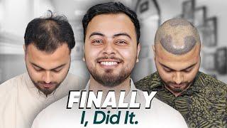 Hair Transplant in Ahmedabad | Best Results & Cost of Hair Transplant in Ahmedabad