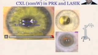 Pearls for combining crosslinking and laser
