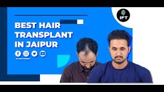 Best Hair Transplant in Jaipur: Affordable & Effective | IFT Hair Science