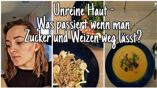 Ernährungsumstellung inkl. Rezepte | Hautprobleme| Spätakne| Die Siwuchins