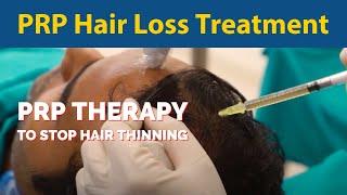 PRP Hair Loss Treatment - PRP Therapy  to stop hair thinning (Platelet Rich Plasma)