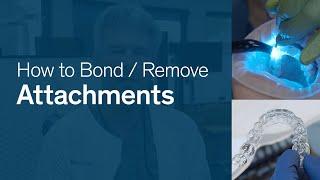 How To Bond & Remove Attachments for Reveal® Clear Aligners