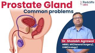  Prostate Gland and Urinary Problems Home Remedies |  Prostate Gland Problems Symptoms & Treatment