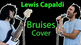 Lewis Capaldi - Bruises Cover - Vivaldi Cristian