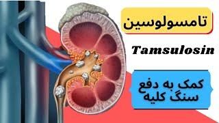 داروی تامسولوسین |tamsulosin| چیست؟ کاربرد و دوز مصرفی تامسولوسین