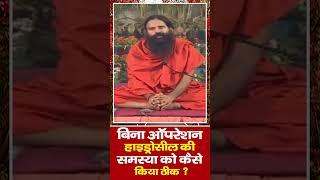 बिना ऑपरेशन (Operation) हाइड्रोसील (Hydrocele) की समस्या को कैसे किया ठीक || Swami Ramdev