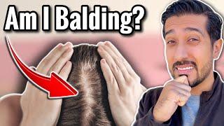 Is it Hair Loss or Hair Shedding? | Shedding Hair vs Hair Loss DIFFERENCE