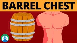 Barrel Chest (Medical Definition) | Quick Explainer Video