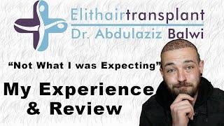 Elit Hair Transplant Experience Review