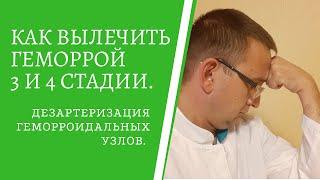 КАК ВЫЛЕЧИТЬ ГЕМОРРОЙ 3 И 4 СТАДИИ? / Дезартеризация геморроидальных узлов.