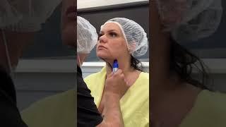 Angelina Castro Chin FlexSculpt procedure with Dr. V